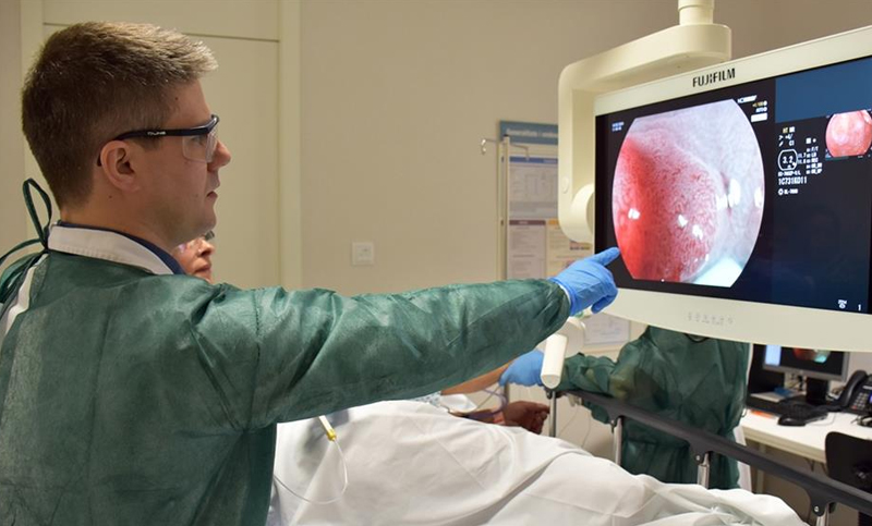 Posibles causas del aumento del cáncer de colon entre jóvenes en los últimos años
