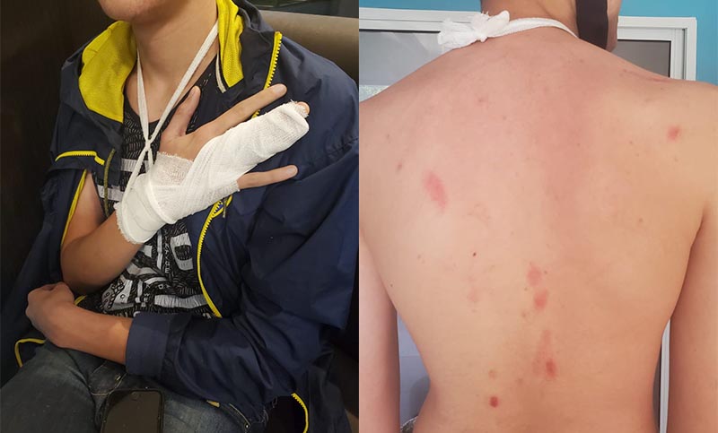 Denunciaron al marido y al hijo de la concejala Martínez por golpear a un adolescente