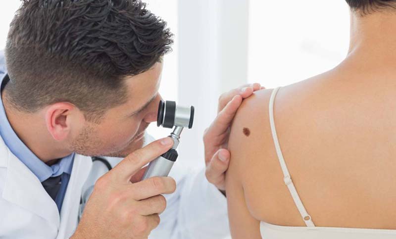 Semana de prevención del cáncer de piel: campañas en todos los efectores públicos