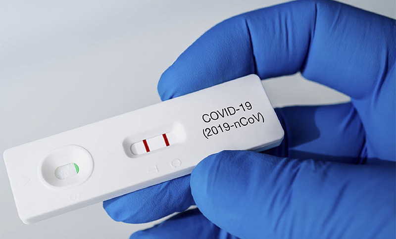 Bioquímicos tomaron posición frente al autotest: «El resultado es orientativo, no diagnóstico»