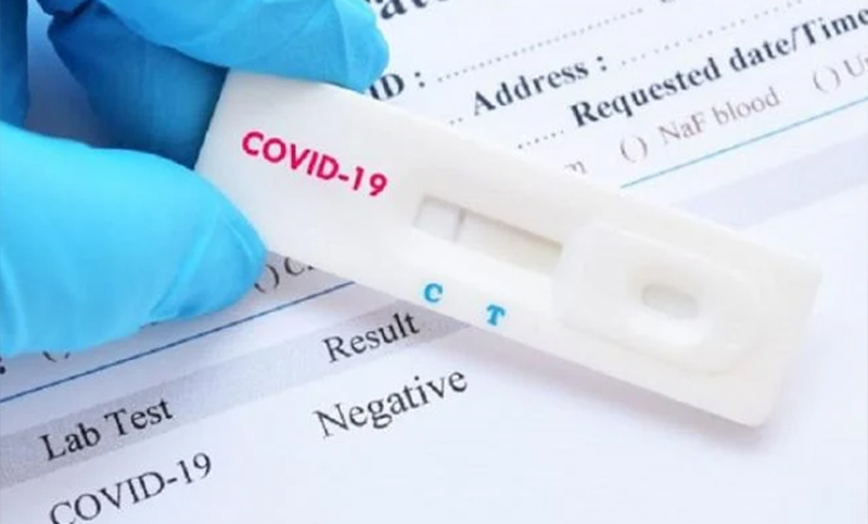 Anmat autorizó el uso de cuatro test de autoevaluación de Covid-19