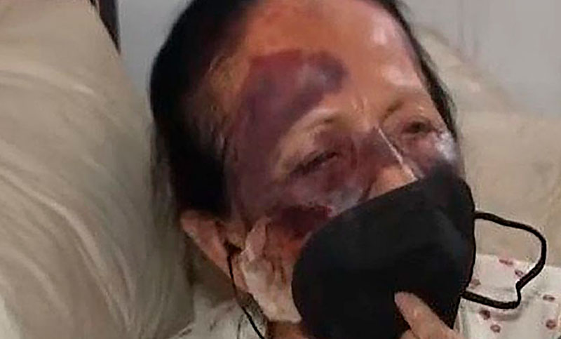 Brutal asalto a una mujer en San Martín: la golpearon y le robaron la jubilación