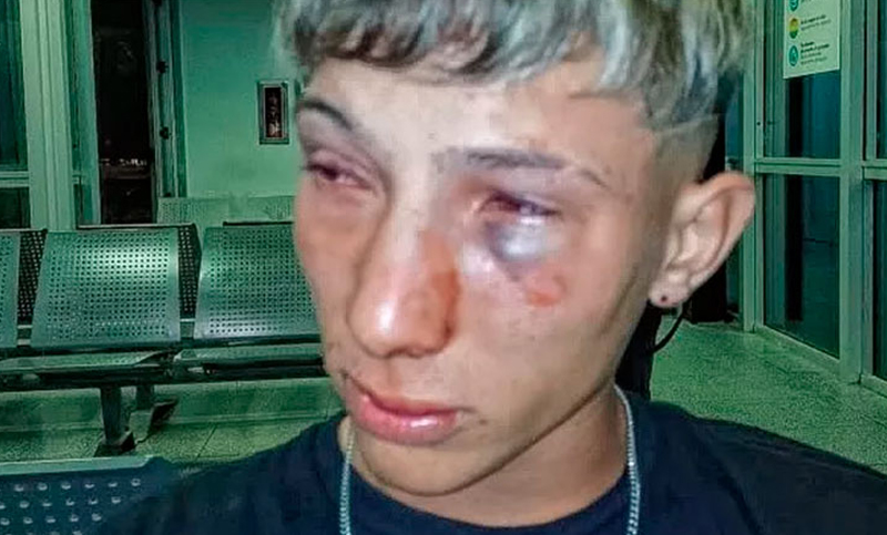 Un joven denunció una brutal golpiza por parte de patovicas de un boliche