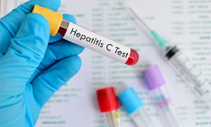 Ocho niños en Argentina podrían tener hepatitis severa de origen desconocido