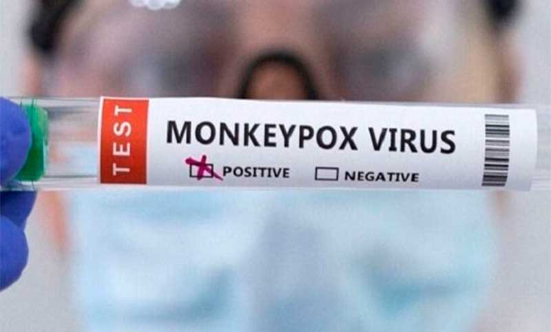 Viruela del mono: reportaron 265 casos en la última semana en el país