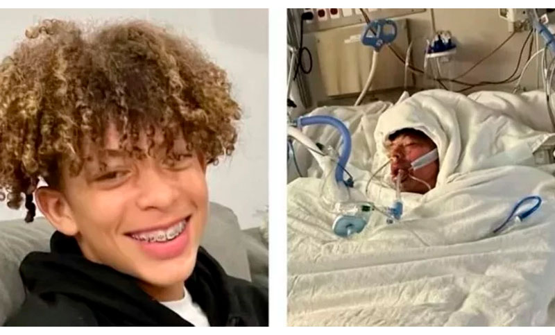 Peligroso desafío de TikTok: un joven de 16 años terminó con el 80% del cuerpo quemado