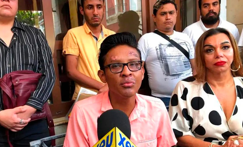 México: en dos semanas hubo cuatro crímenes de odio contra el colectivo LGBT+