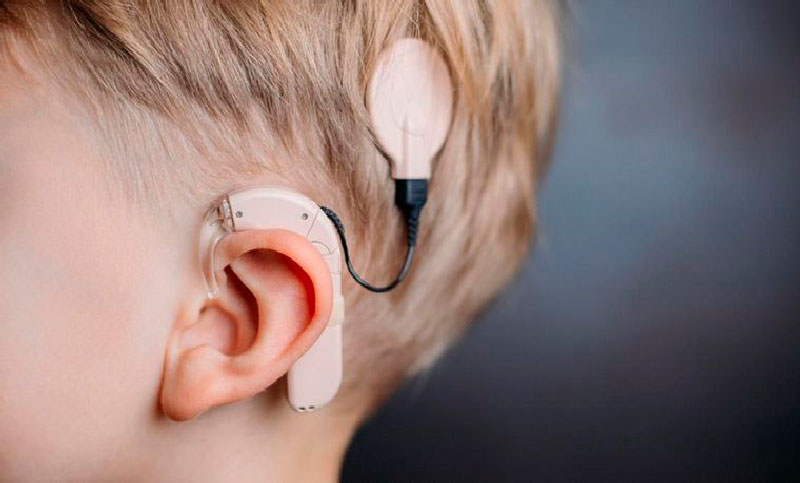 Día del Implante Coclear: 500 mil personas viven con problemas auditivos en la Argentina