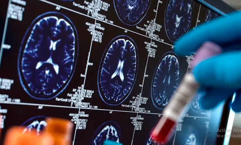 Un nuevo estudio abre la puerta a un tratamiento del Alzheimer sin fármacos