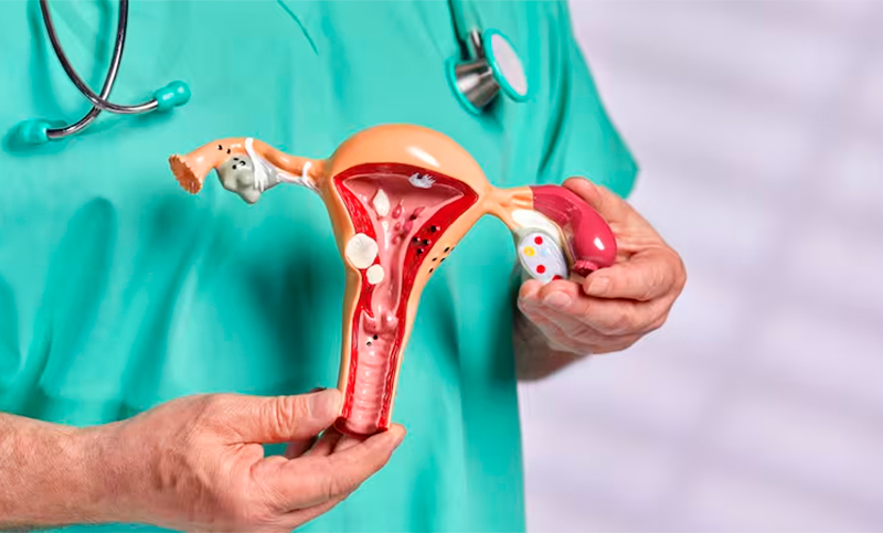 Día mundial del Cáncer de Ovario: cada año se diagnostican 2.700 nuevos casos en Argentina