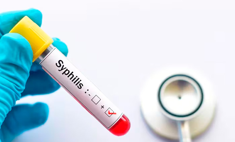 Alerta por el aumento de casos de sífilis en Argentina, enfermedad que se creía erradicada