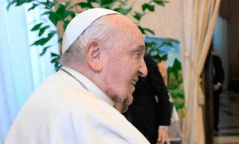 Francisco sorprendió con un hematoma en su rostro durante las actividades en el Vaticano