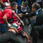 Un fotógrafo está en estado crítico tras ser herido en la cabeza por la policía de Bullrich 