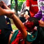 «Todo pasó en un minuto», el relato del fotógrafo que tomó las impactantes imágenes de Pablo Grillo