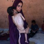 La hambruna en Gaza, contada por una enfermera en primera línea: “Cada semana los números son mayores”