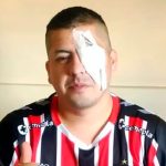 Represión en el Congreso: indagarán al prefecto acusado de disparar a hincha que perdió la visión de un ojo