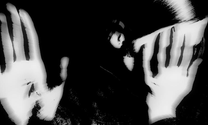Una mujer está internada tras haber sido quemada con ácido: denunció que fue agredida por su ex pareja quien la tuvo secuestrada