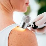 Cáncer de piel: habrá controles dermatológicos gratuitos en la Calle Recreativa y en hospitales públicos