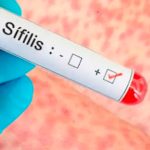 Un notable aumento de los casos de sífilis revela la “crisis” en el sistema de salud y en la ESI