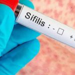 Alertan por un aumento del 20,5% en los casos de sífilis en Argentina