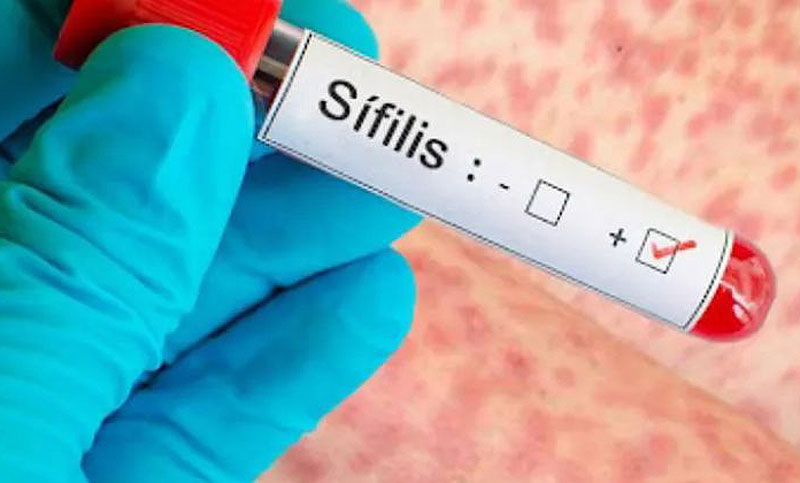 Alertan por un aumento del 20,5% en los casos de sífilis en Argentina