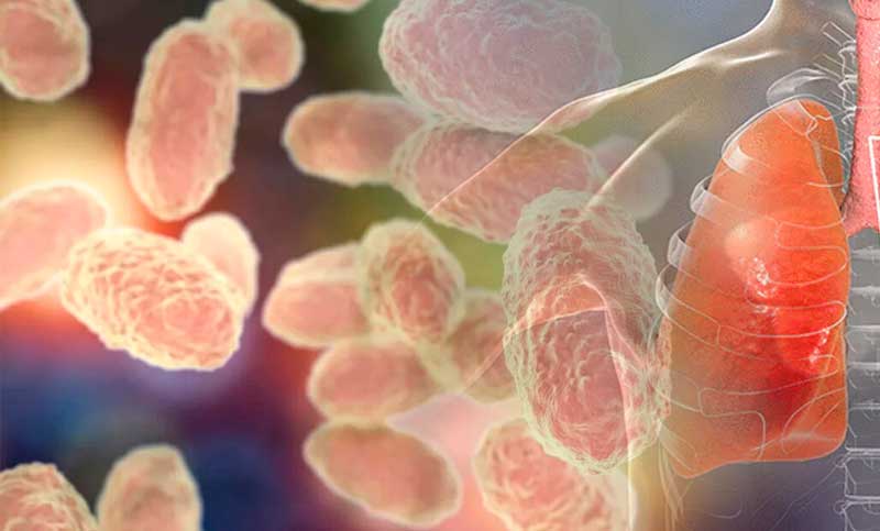 Crece la preocupación por aumento de casos de coqueluche: se confirmaron 81 nuevos contagios y ya suman más de 800 en todo el país