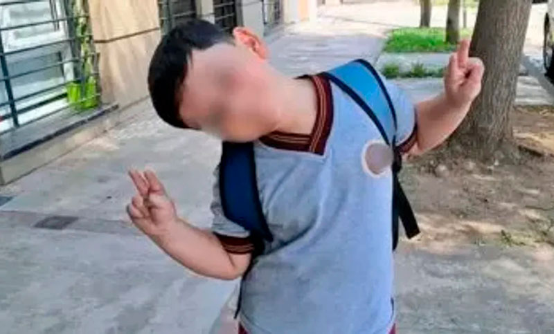 Bastián fue operado por séptima vez y continúa en terapia, ¿qué tipo de cirugía le realizaron?