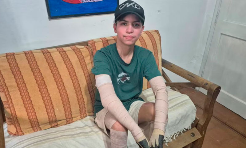 Dieron el alta a un adolescente que sufrió quemaduras en el 68% del cuerpo tras la explosión de su celular