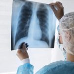 Tuberculosis: actualizan las pautas técnicas para su abordaje