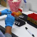 Se registraron casi 47 mil casos de sífilis en Argentina y crece la alarma por la tasa de aumento