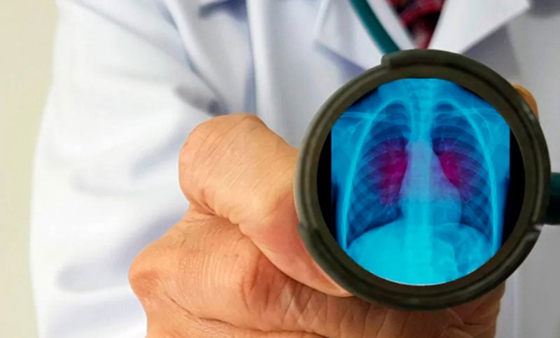 Aumentan los casos de bronquiolitis y neumonía por el avance del Virus Sincicial Respiratorio