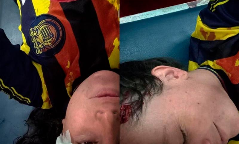 Habló Brenda, la hincha de Central atacada con un ladrillo en calle Pellegrini: «Me tiró a matar y gracias a Dios lo puedo contar»